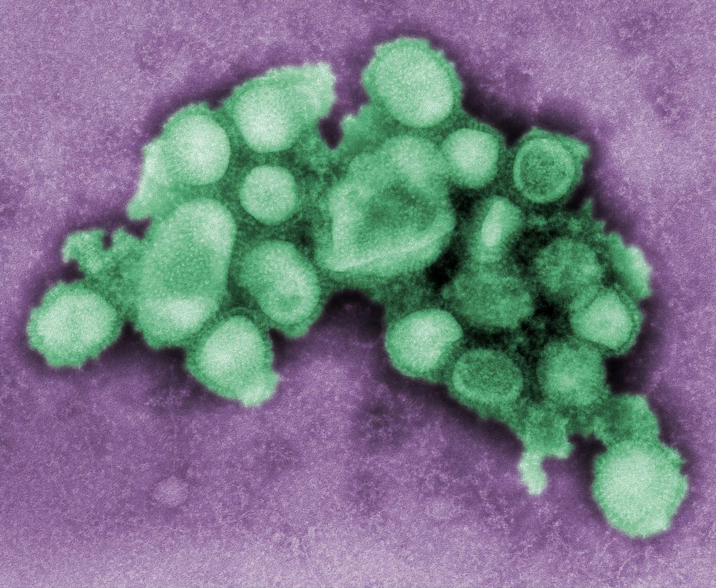 Ultrastructural morphology of the A/CA/4/09 Swine Flu virus